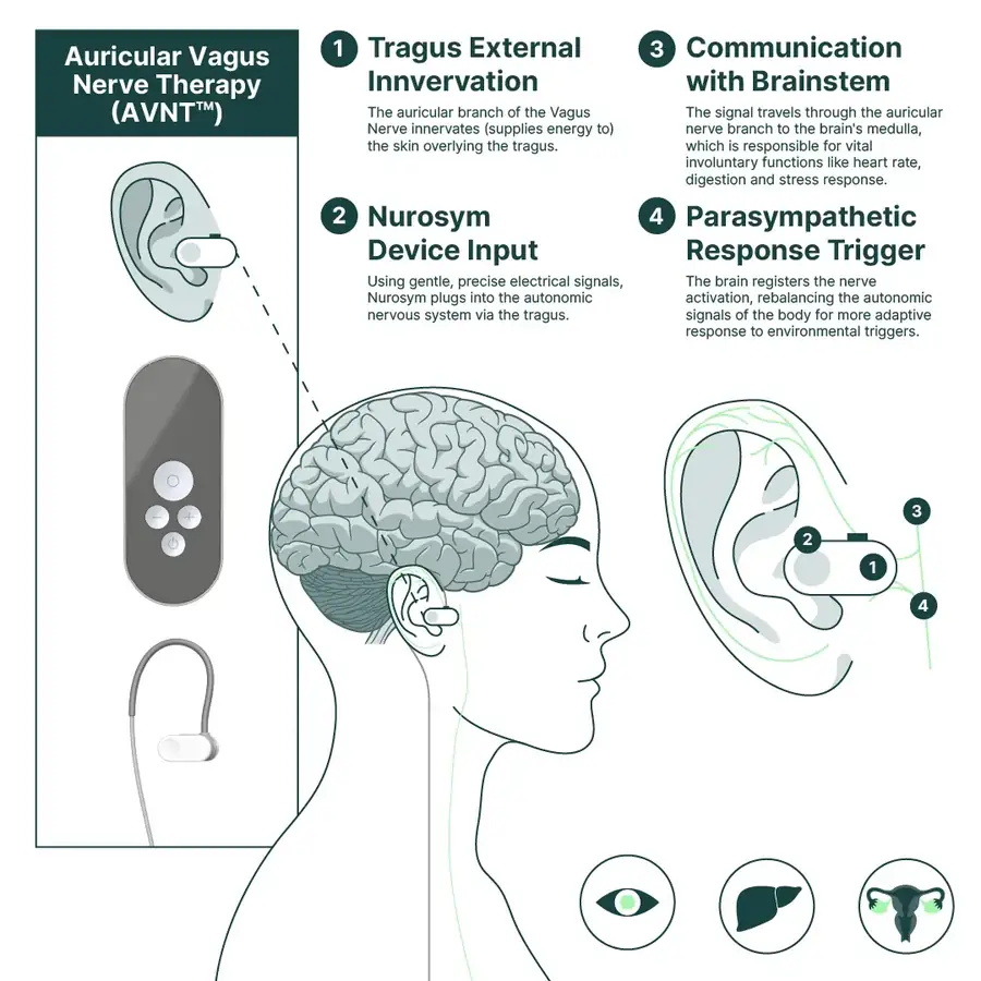 Nurosym auricular VNS device